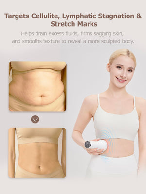 DiDEER Lymphatic Drainage Massager & Anti Cellulite Massage Tool, for Legs, Arms & Belly, Body,Helps Reduce Stretch Marks & Cellulite,with Microcurrent, Light Heat & Vibration DiDEER buy supplements Au