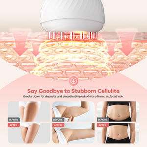 HarrFlow Lymphatic Drainage Massager & Anti Cellulite Massage Tool, Lymphatic Massager,Helps Reduce Stretch Marks & Cellulite,for Belly, Arms & Legs,Body Sculpting Machine with Heat & Vibration HarrFlow buy supplements Au