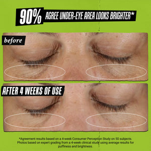 Kiehl's Avocado Eye Treatment, Nourishing and Hydrating Eye Cream, Avocado Oil and Caffeine to Energize and Invigorate Skin, Tired Eyes - PrimeBioHealth - canada supplements