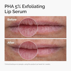 The Ordinary PHA 5% Exfoliating Lip Serum, Hydrating Overnight Lip Exfoliator Treatment, 0.5 Fl Oz - PrimeBioHealth - canada supplements