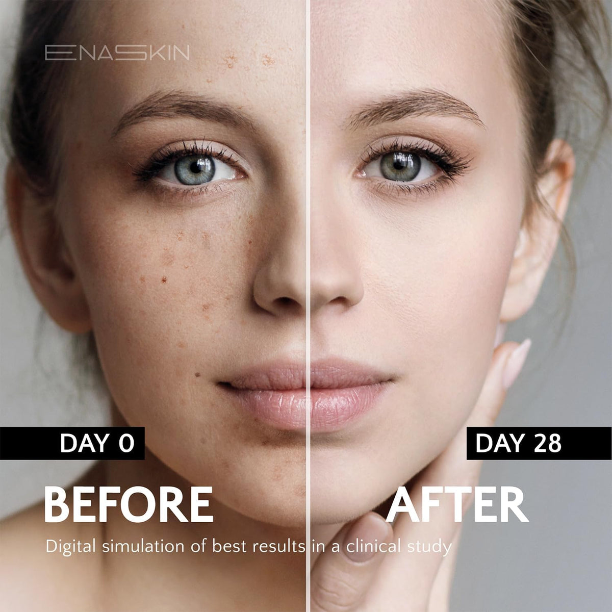 EnaSkin Dark Spot Remover for Face and Body: Advanced Formula Spot Corrector Cream to Fade Age Spots, Sun Spots, Freckles - PrimeBioHealth - canada supplements
