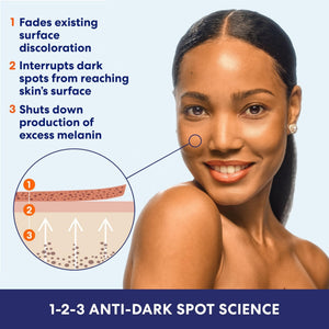 Palmer's Skin Success Anti-Dark Spot Fade Milk Body Lotion, 8.5 Ounce - PrimeBioHealth - canada supplements