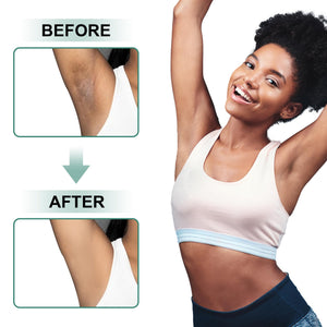 Vcetree Skin Bleaching Cream Skin Lightening for Body Intimate Areas, Private Parts, Underarm, Knees, Elbows, Inner Thigh, Bikini Area - PrimeBioHealth - canada supplements