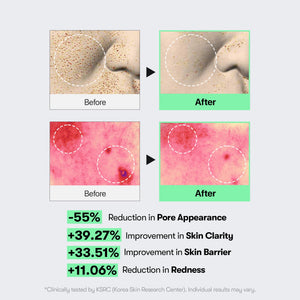 VT COSMETICS CICA Reedle Shot 100, Spicule Microneedling Serum for Pore Care & Exfoliation, Exosome, Centella Asiatica for Glass Skin - PrimeBioHealth - canada supplements
